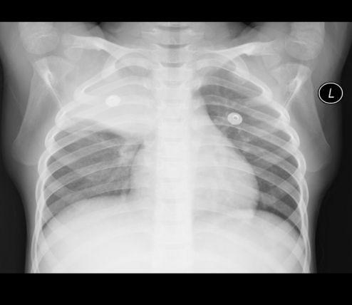 胸片爆料2025年最新版